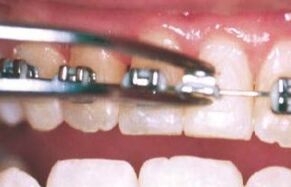 Defiance Orthodontist